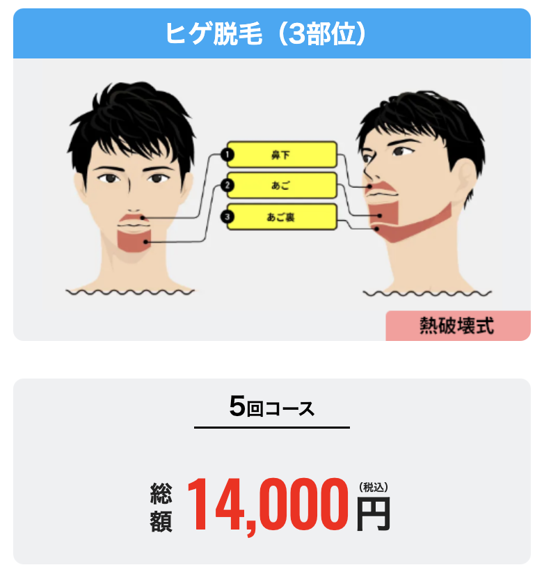 メンズリゼの髭脱毛３部位5回のロゴ