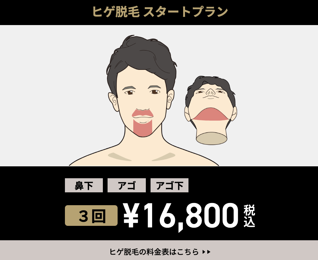 ゴリラクリニックの髭脱毛スタートプラン料金と回数
